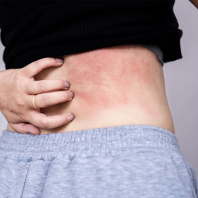 Viêm gan B có gây ngứa không? Nguyên nhân gây ngứa do đâu?