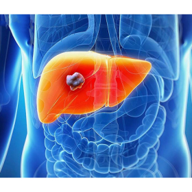 Viêm gan B mạn tính là gì? Viêm gan B mạn tính có chữa được không?