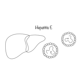 Viêm gan E: Nguyên nhân, triệu chứng, chẩn đoán và cách điều trị