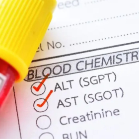 Xét nghiệm gan nhiễm mỡ gồm những gì? Các chỉ số cần biết