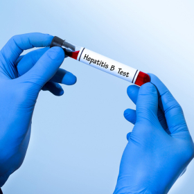 Xét nghiệm viêm gan B bao lâu có kết quả? Người khám cần biết