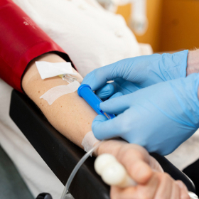 Xét nghiệm viêm gan B có cần nhịn ăn không? Lưu ý trước khi xét nghiệm