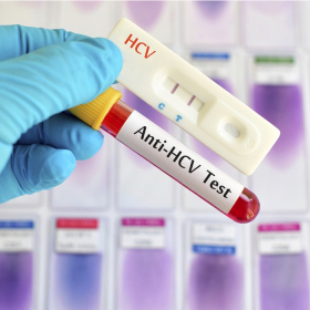 Tìm hiểu chi tiết về xét nghiệm viêm gan C