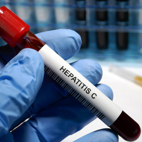 Xét nghiệm viêm gan C có cần nhịn ăn không? Những điều bạn phải biết