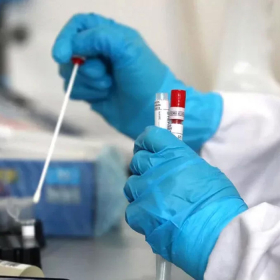 Xét nghiệm viêm gan E là gì? Phương pháp xét nghiệm phổ biến