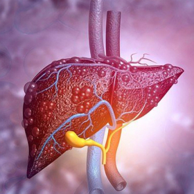 Xơ gan F2 là gì? Xơ gan F2 có nguy hiểm không?