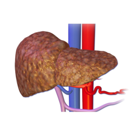 Xơ gan giai đoạn 2 có chữa được không? Phương pháp điều trị bệnh