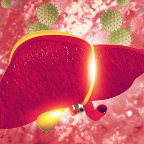 Xơ gan ứ mật là gì? Nguyên nhân, biểu hiện và cách điều trị